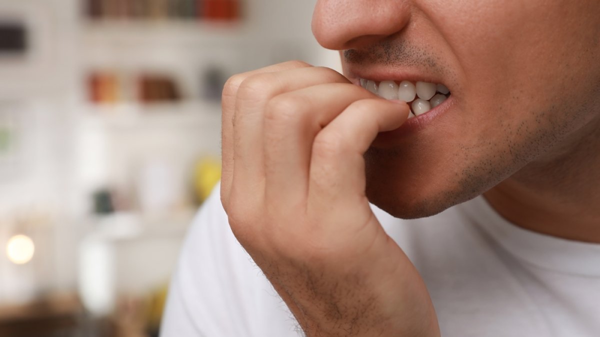 Habit Replacement Strategy: A Proven Method to Stop Nail Biting, Skin ...